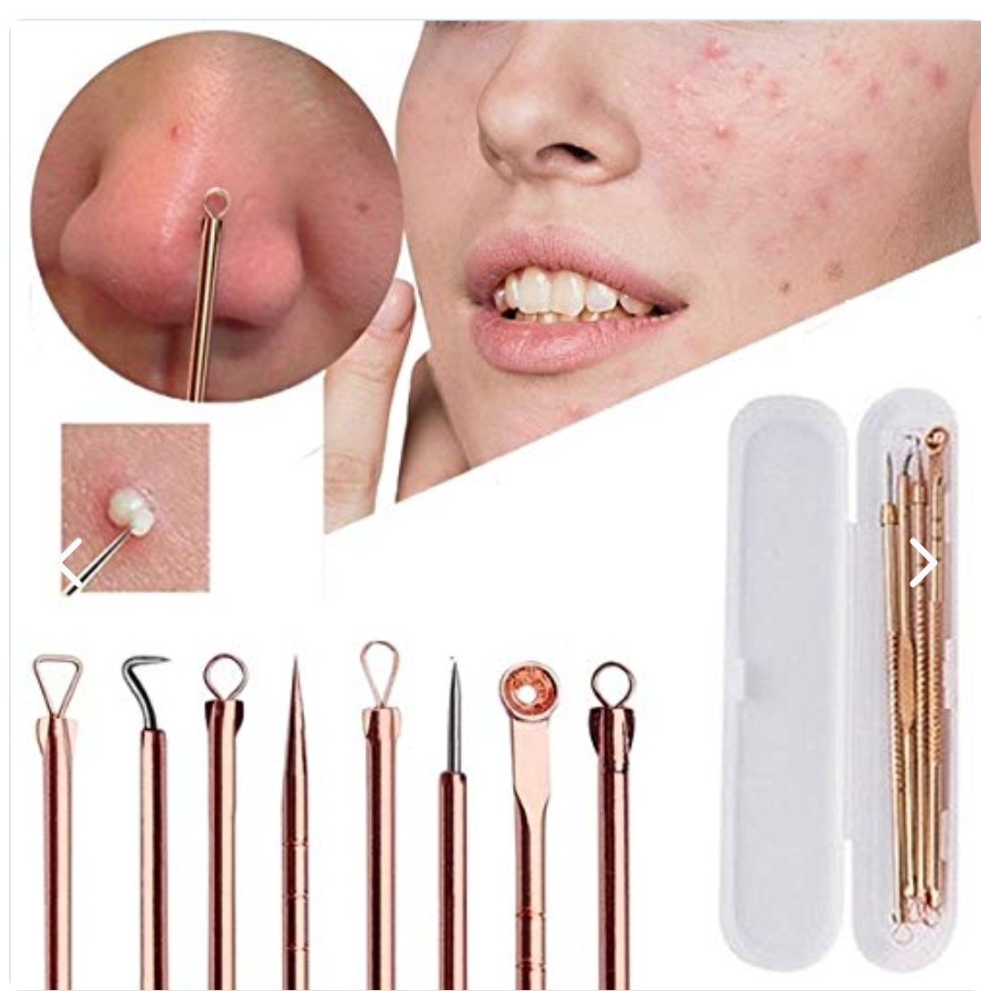Kit anti acne