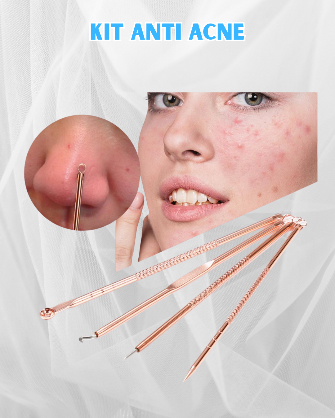 Kit anti acne